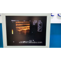 China cheap ultrasound trolley & medical ultrasound scanner price DW370 model